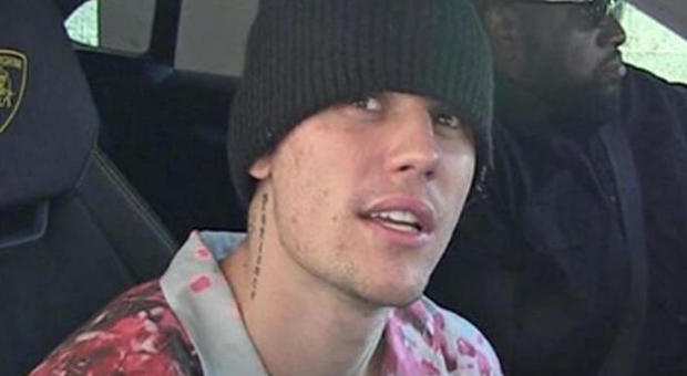 Justin Bieber choc su Instagram: «Non sono drogato, sono malato». Ha la malattia di Lyme