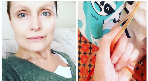 Sabrina Parravicini e la lotta contro il cancro: il post drammatico su Instagram dopo l'operazione
