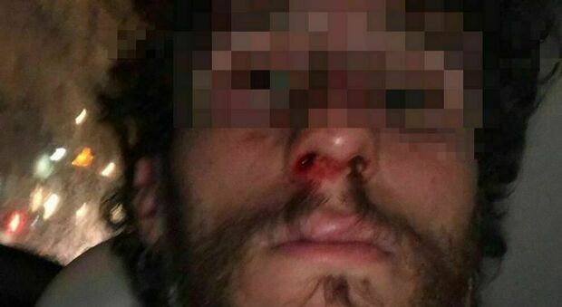 Aggressione omofoba nella piazza di Napoli: insultato e picchiato da dieci persone