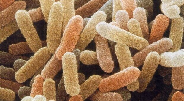 Listeria, cos'è, come agisce e come ci si difende dal batterio che provoca l'infezione alimentare