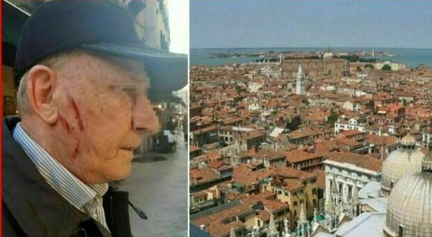 Venezia, pensionato blocca le borseggiatrici, ma le ladre lo feriscono e lo sfidano: «Chiama pure la polizia, siamo incinte»