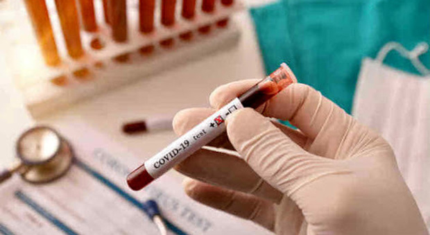 Coronavirus, da Roche test sierologico disponibile da maggio Come funziona