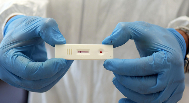Orvieto, screening tramite test sierologici rapidi su duemila persone