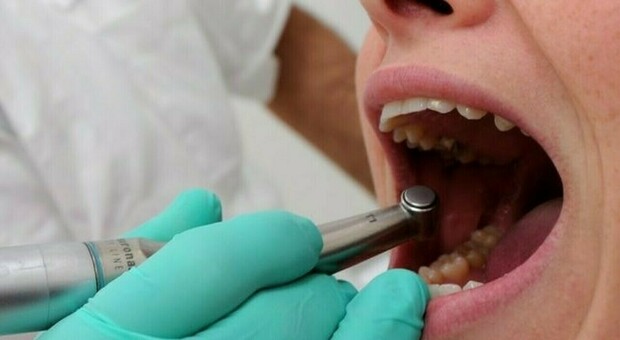 Dentista dei Vip nei guai, la Cassazione conferma la condanna: «Bocca rovinata alla paziente»